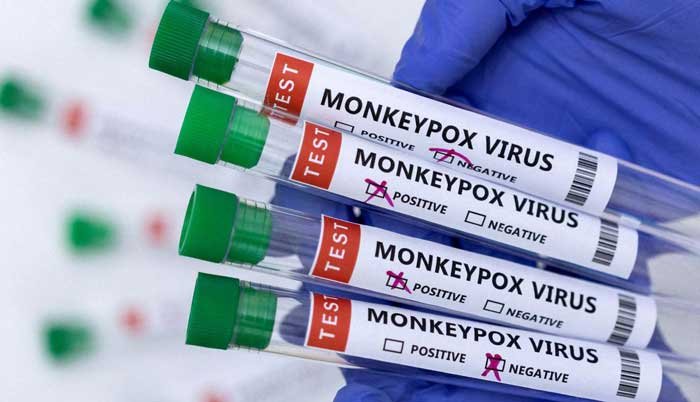 Monkeypox outbreak: How to protect yourself against monkeypox virus and what to do if you have symptoms
