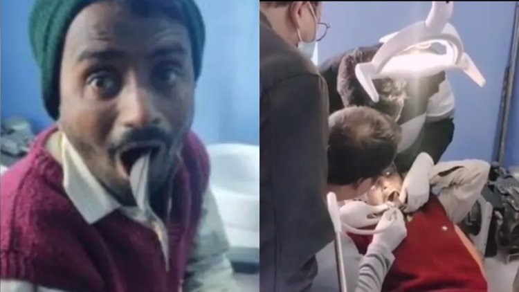 Viral Video: The man stuck the scabbard in his own mouth in a prank, even the doctor was surprised to see