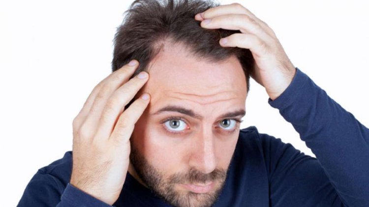 Hair flying like money from the head? So these 8 home remedies will help men suffering from hair loss